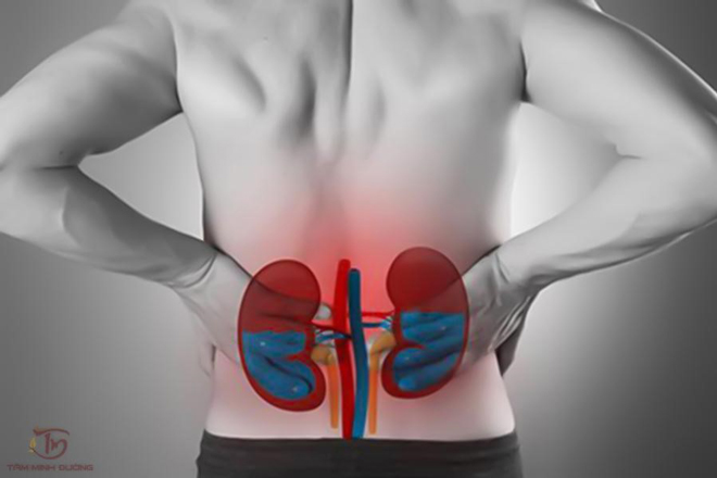 Chữa thận ứ nước độ 2 bằng Cao Bổ Thận Tâm Minh Đường - 3