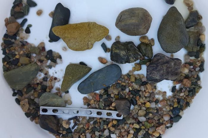 Thanh chỉnh hình và sỏi đá tìm thấy trong bụng cá sấu MJ