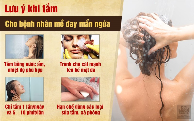 Bệnh nổi mề đay mẩn ngứa (phong ngứa): Triệu chứng, nguyên nhân, cách điều trị - 3