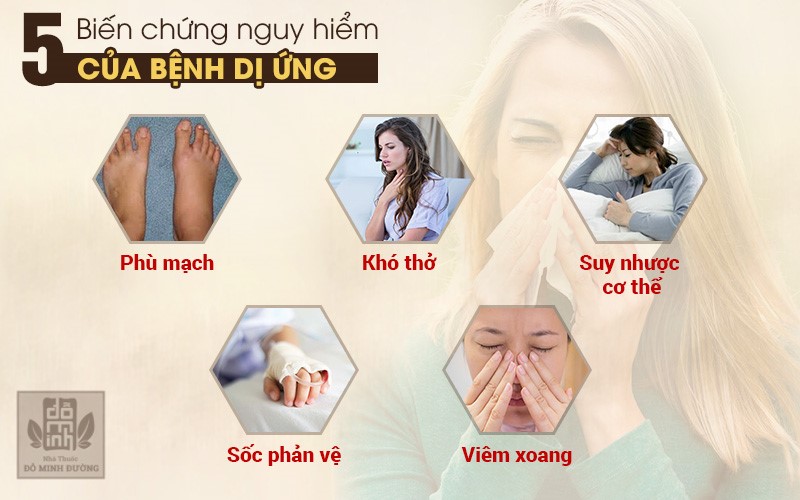 Dị ứng nổi mề đay mẩn ngứa mãn tính: Triệu chứng và cách điều trị không tái phát - 1