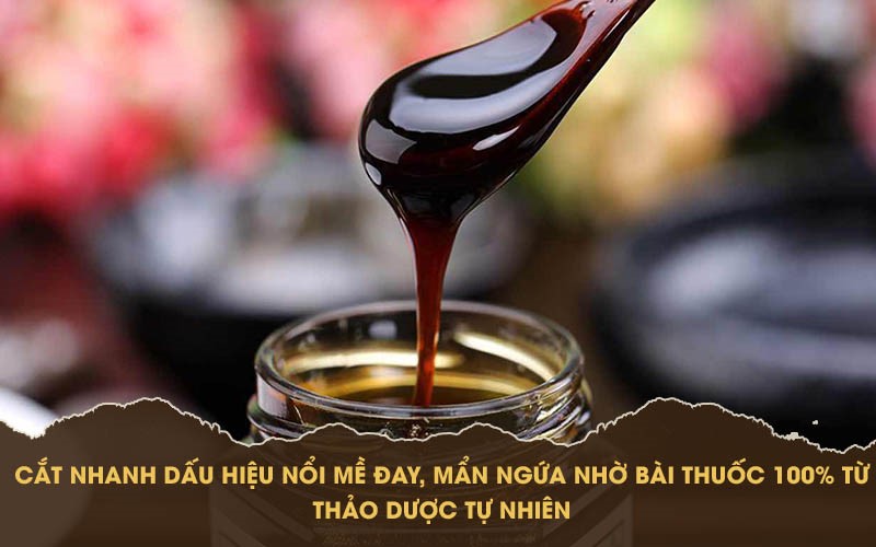 Dị ứng nổi mề đay mẩn ngứa mãn tính: Triệu chứng và cách điều trị không tái phát - 3