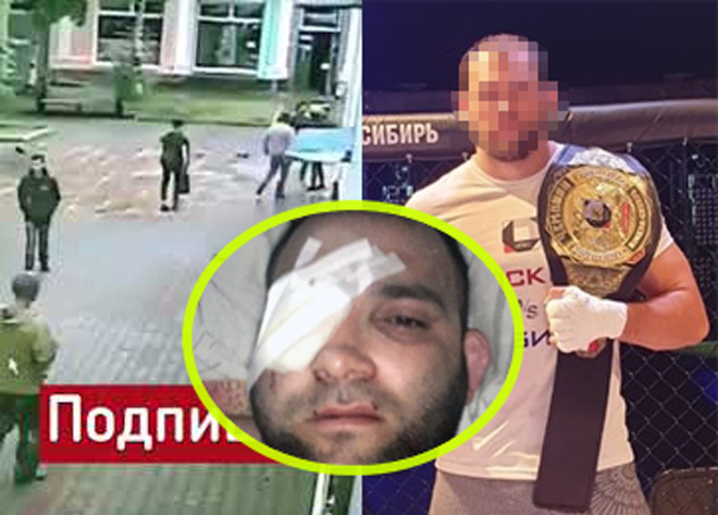 Abdul Zakharov bị cảnh sát tại Nga đấm "chột" mắt