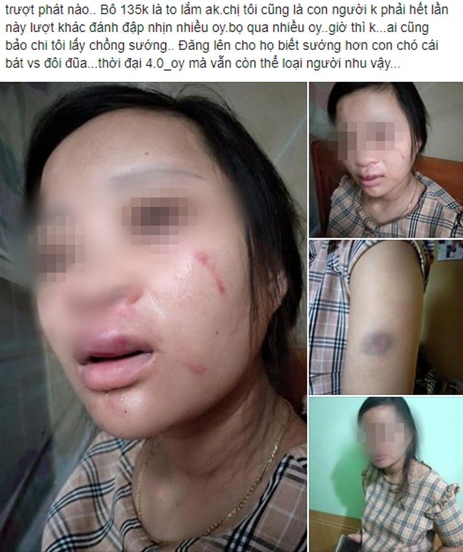 Hình ảnh chị Th. cùng nội dung tố cáo việc đánh vợ trên mạng xã hội gây bức xúc.