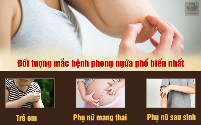 Bệnh phong ngứa là gì? Nguyên nhân, triệu chứng và cách chữa hiệu quả - 1