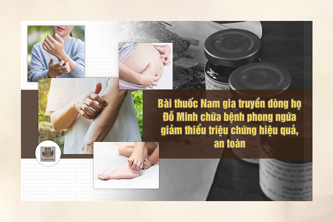 Bệnh phong ngứa là gì? Nguyên nhân, triệu chứng và cách chữa hiệu quả - 3