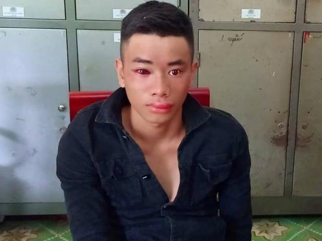 Pháp luật - Đối tượng nghiện dùng kim tiêm đâm Thiếu úy công an để thoát thân