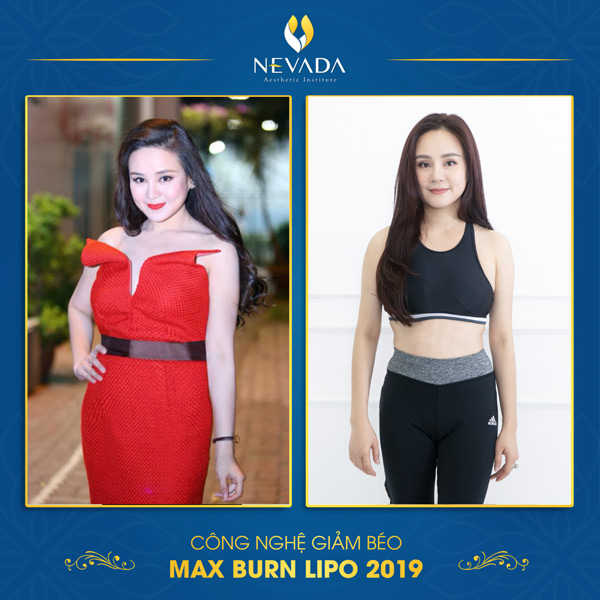 Ca sỹ Vy Oanh giảm cân bằng công nghệ Max Burn Lipo