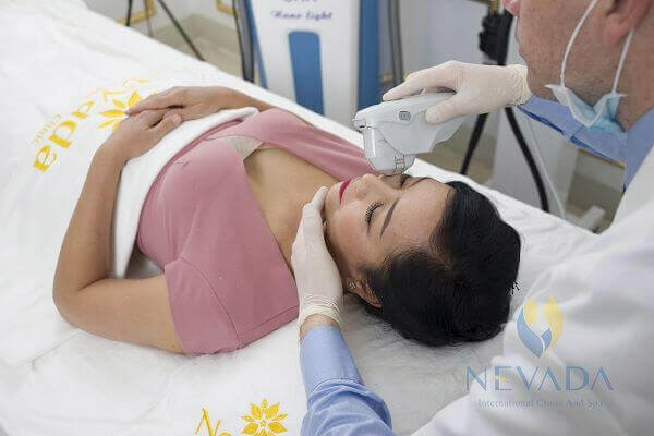 Diễn viên Chiều Xuân dùng Ultherapy để trẻ hóa da