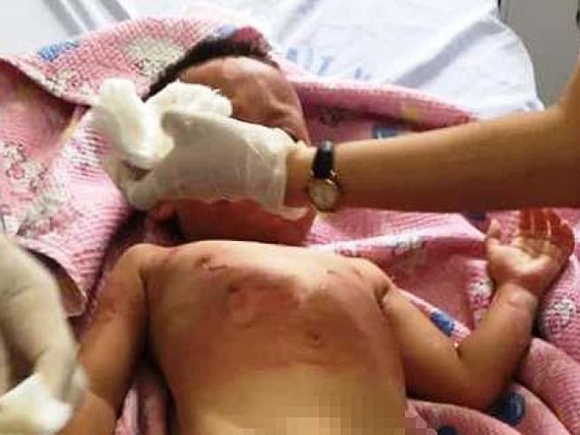 Tin tức trong ngày - Vụ 3 trẻ bị bỏng trong lúc học kỹ năng thoát hiểm: Bộ GD-ĐT vào cuộc