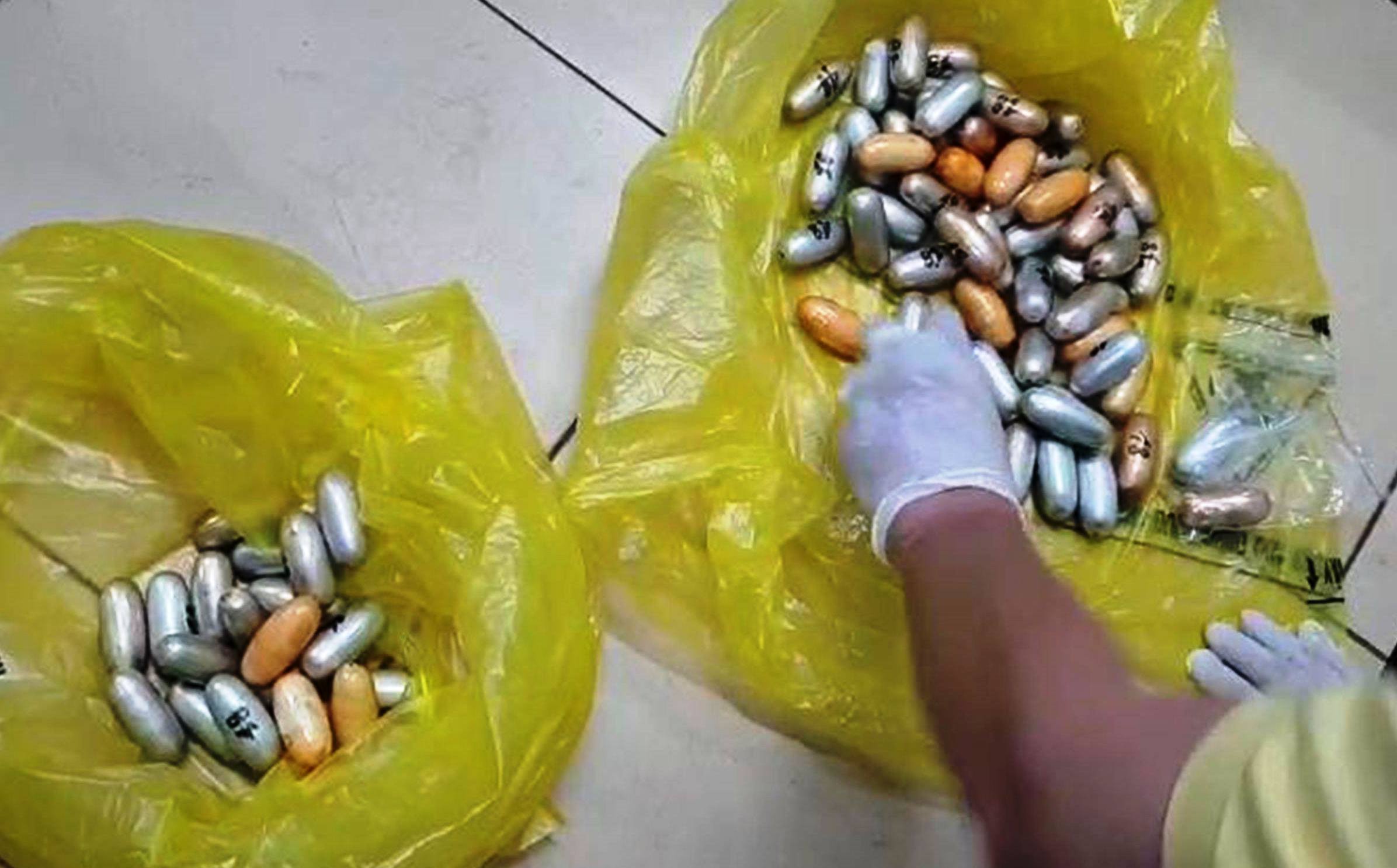 Bí mật khủng khiếp trong bụng của người nước ngoài bị phát hiện ở sân bay Tân Sơn Nhất - 2