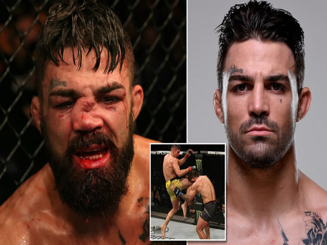 Thể thao - Rợn tóc gáy mũi võ sỹ biến dạng vì ăn đòn: "Ngồi chơi xơi nước" nửa năm