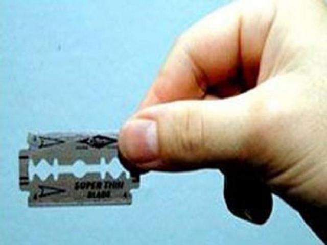 Pháp luật - Nữ công nhân bị bạn trai rạch mặt