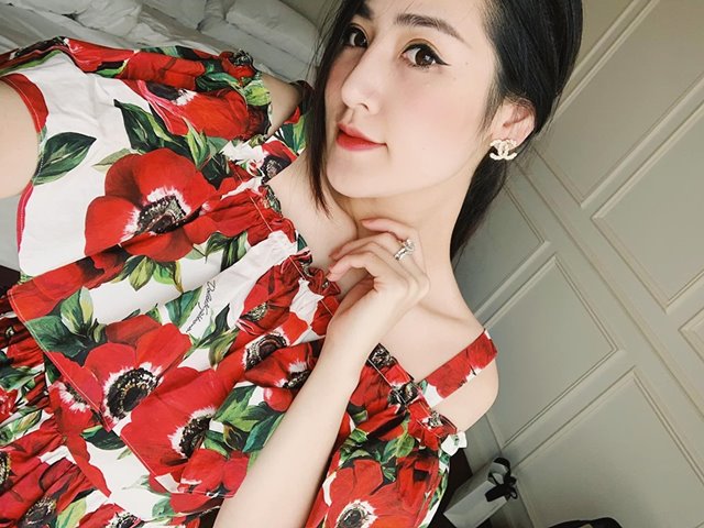 Làm đẹp - "Nghi vấn" á hậu Tú Anh chỉnh sửa mũi