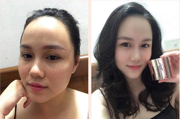 Chị Hoàng My (Facebook/hoang.my.758) là người đã sử dụng Anti Mela Cream sau 9 tuần đã lấy lại được sự hồng hào, trắng sáng mịn màng cho khuôn mặt.