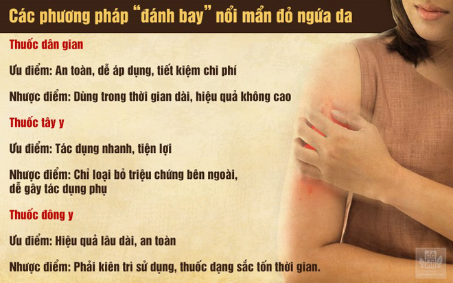 Nổi mẩn đỏ ngứa da là bệnh gì? Đâu là cách chữa hiệu quả, không tái phát? - 4