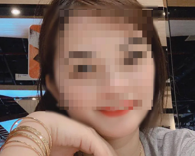 Cô gái xinh đẹp trước khi tiêm mỡ&nbsp;tự thân.