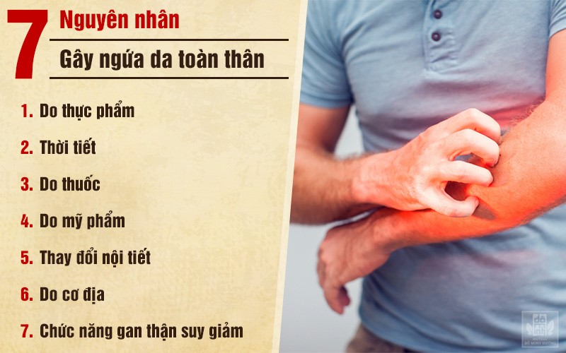 Ngứa toàn thân do nổi mề đay: Nguyên nhân và cách điều trị hiệu quả - 2