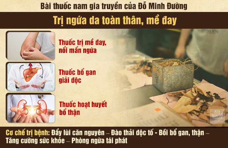 Ngứa toàn thân do nổi mề đay: Nguyên nhân và cách điều trị hiệu quả - 4