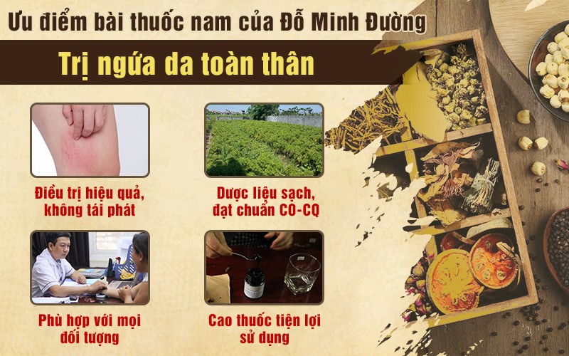 Ngứa toàn thân do nổi mề đay: Nguyên nhân và cách điều trị hiệu quả - 5