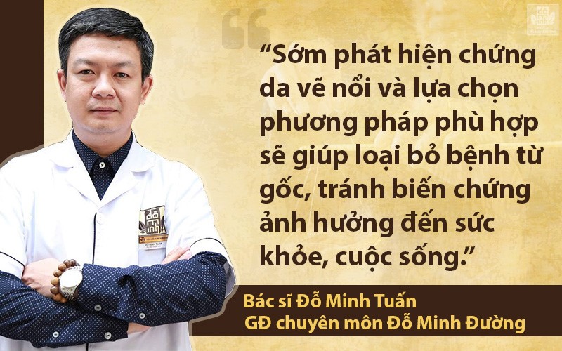 Da vẽ nổi là bệnh gì? Biểu hiện dị ứng da vẽ nổi và cách điều trị hiệu quả - 3
