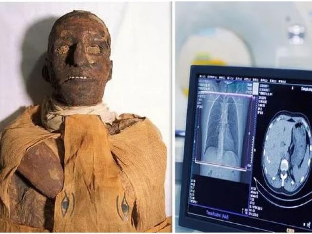 Chụp cắt lớp xác ướp pharaoh Ai Cập 3.000 tuổi, phát hiện bí mật choáng váng