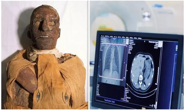 Chụp cắt lớp xác ướp pharaoh Ai Cập 3.000 tuổi, phát hiện bí mật choáng váng - 2