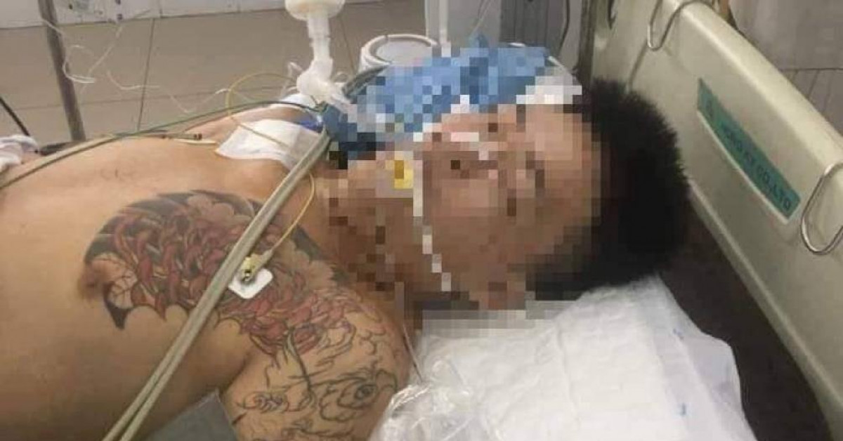 Pháp luật - Bị can 17 tuổi nguy kịch khi bị tạm giam: Tử vong sau gần 2 tháng điều trị