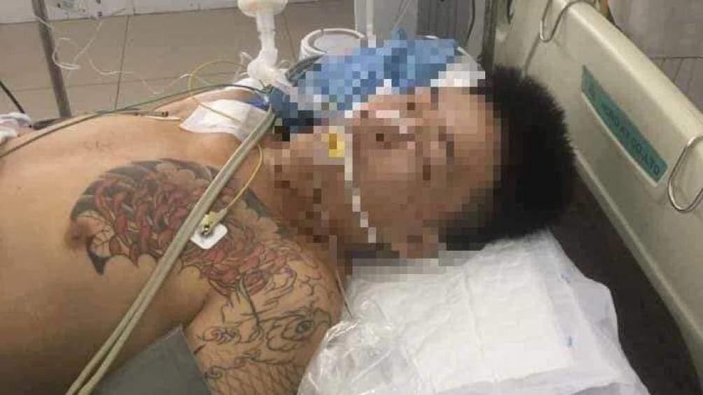 Bị can Trần Văn Hiền đã tử vong sau gần 2 tháng được điều trị tại bệnh viện