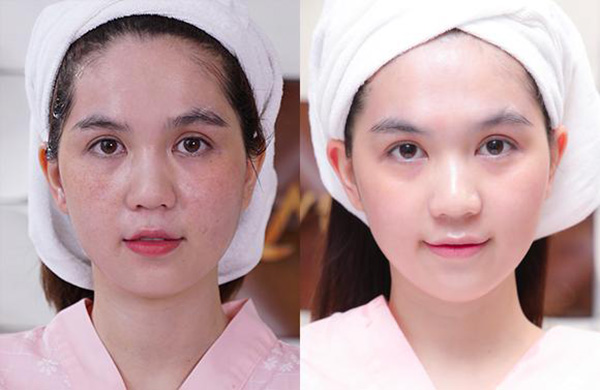 Ưu đãi “sập giá mỗi ngày” loạt công nghệ làm đẹp “ruột” của Ngọc Trinh - 5