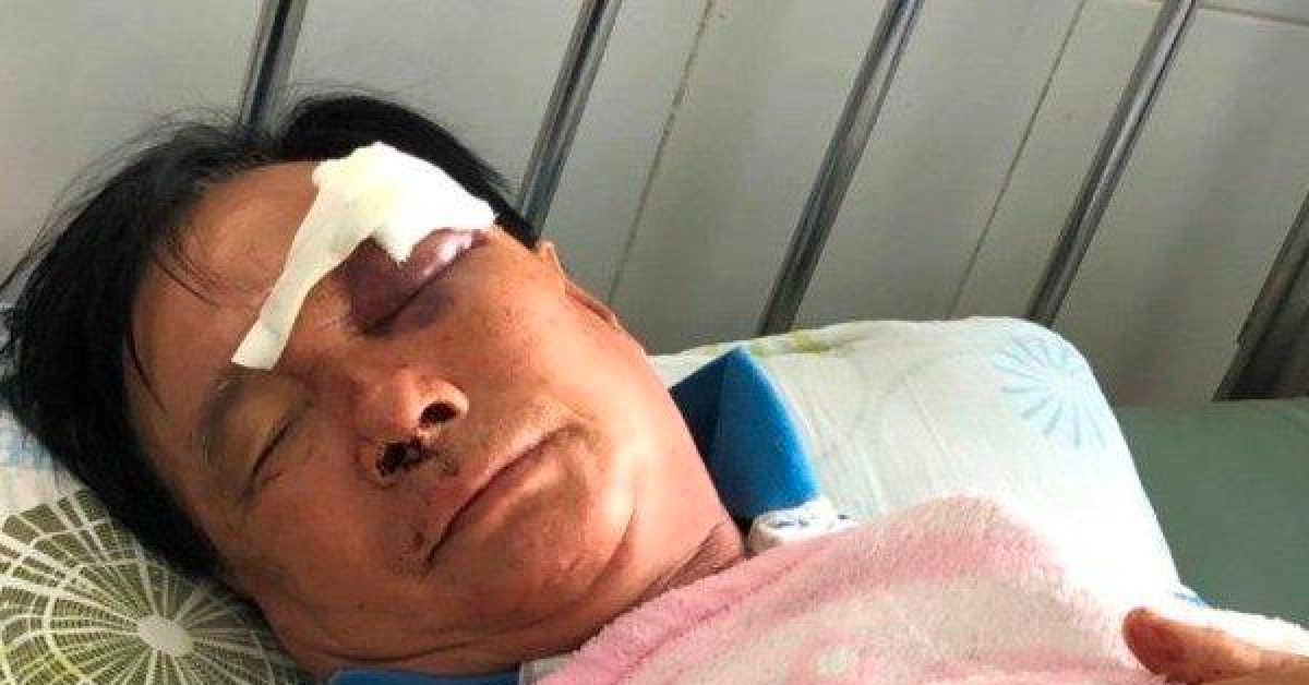 Pháp luật - Cha vợ ngậm ngùi tiết lộ lý do bị các con rể đánh nhập viện cấp cứu