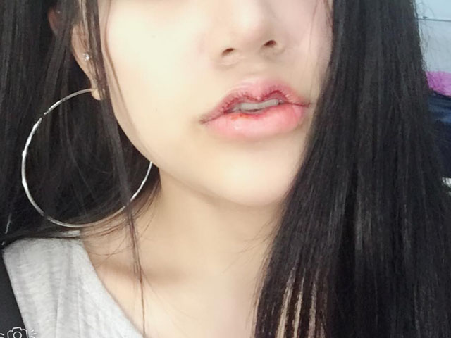 Làm đẹp - Nhiều người hết hồn vì trào lưu "môi hở răng lạnh" của chị em Việt