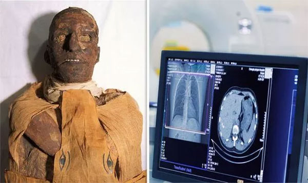 Các nhà khoa học thực hiện chụp CT xác ướp của pharaoh Ramses III.