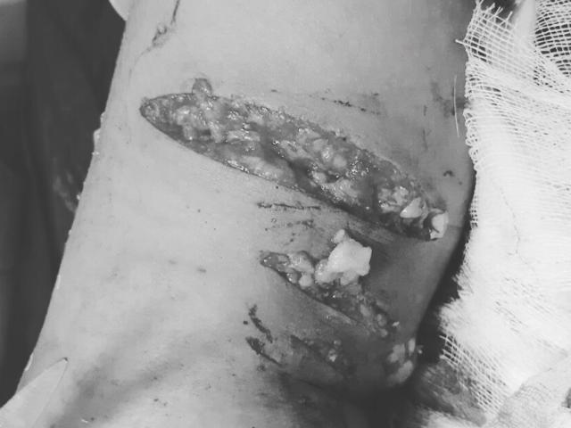 Sức khỏe đời sống - Kinh hoàng, trẻ 7 tuổi bị chó nhà hàng xóm cắn phải khâu 70 mũi