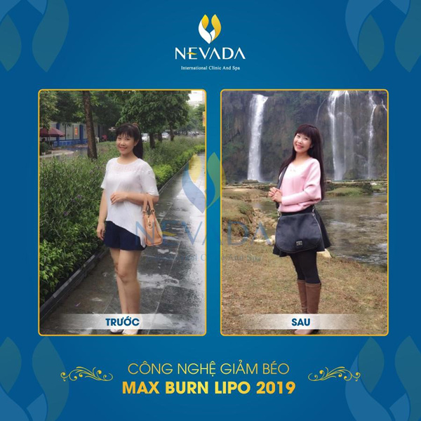 Diễn viên Hương ‘’tươi’’ trước và sau khi dùng Max Burn Lipo