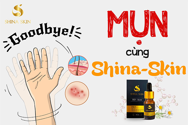 Shina Skin - Thương hiệu mới tạo nên cơn sốt trên thị trường mỹ phẩm Việt Nam - 1