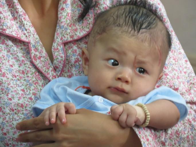 Những "thiên thần áo trắng" đã giành lại sự sống cho bé Phát