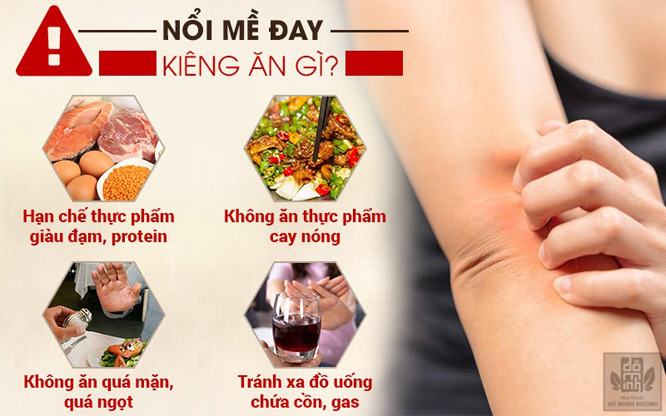 Bị nổi mề đay nên ăn gì? Kiêng gì? Chữa thế nào để hết mẩn ngứa? - 2