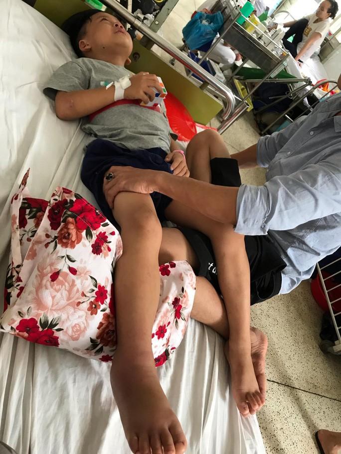 Cháu Lê Nguyễn Đăng Quân đang điều trị tại Bệnh viện Nhi Đồng 2. Ảnh chị Thảo cung cấp