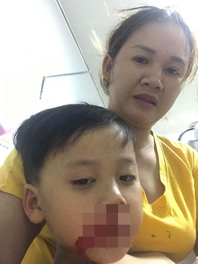 Hình ảnh chị Thảo đăng tải trên mạng xã hội gây xôn xao dư luận