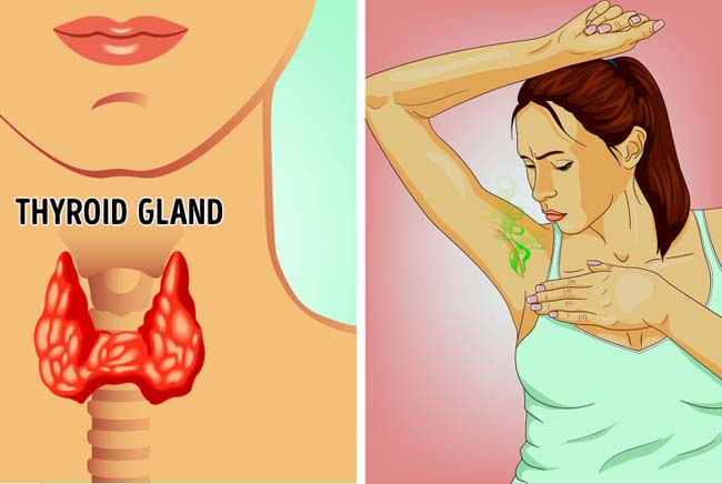 Chữa mãi không hết mùi mồ hôi cơ thể thì đây chính là lý do - 3