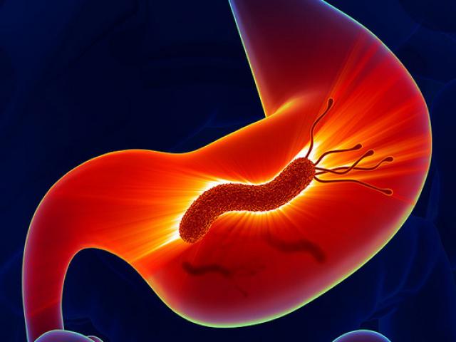 Sức khỏe đời sống - Dạ dày dễ mắc tỉ thứ bệnh vì nhiều người có những sai lầm khủng khiếp này