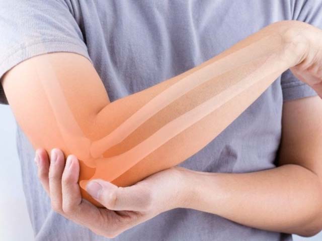 Sức khỏe đời sống - 7 trường hợp bệnh viêm khớp có thể trở thành ung thư ít ai biết