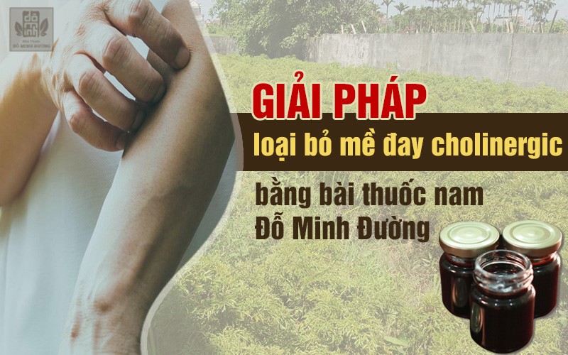 Mề đay cholinergic: Nguyên nhân, triệu chứng và các cách điều trị không kháng sinh - 4
