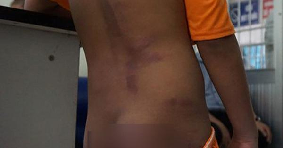 Pháp luật - 4 anh em họ ở Cà Mau bị đánh rồi xát muối ớt vào vết thương