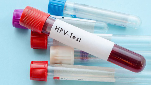 Loại virus gây 2 loại ung thư ám ảnh phụ nữ, có thực sự đáng sợ đến vậy? - 1