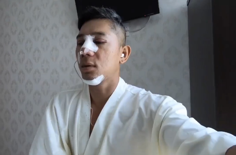 Sao phim "Thái sư Trần Thủ Độ" đã phẫu thuật thẩm mỹ những gì? - 8