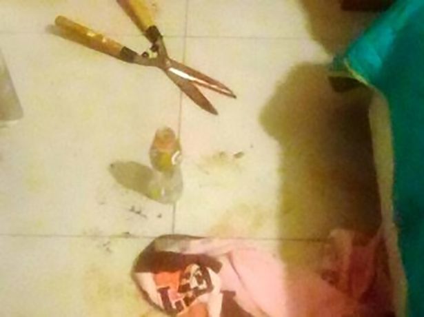 Chiếc kéo người phụ nữ 27 tuổi dùng để cắt "của quý" người tình