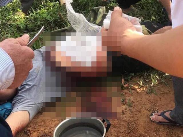 Pháp luật - Nghĩ trong bụng có bom, thanh niên cầm dao tự rạch bụng mình