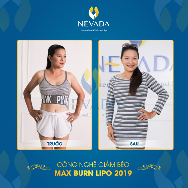 Diễn viên Kiều Trinh ‘’lột xác’’ nhờ Max Burn Lipo