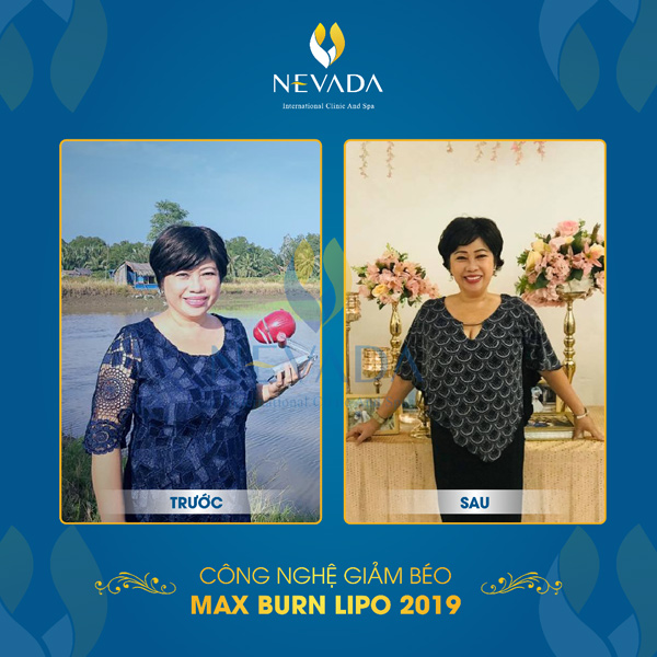 Kết quả giảm cân bằng Max Burn Lipo của diễn viên Phi Phụng